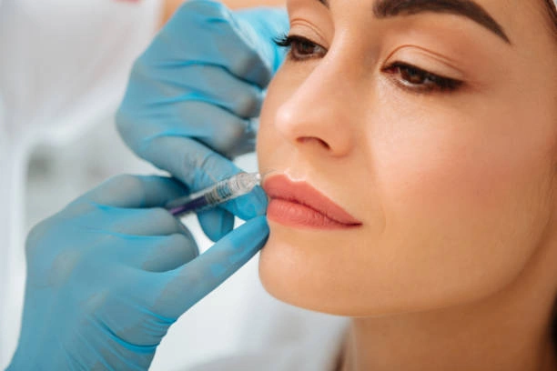 تقنية توريد الشفاه بالفيلر