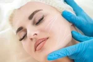 إزالة التصبغات بالليزر