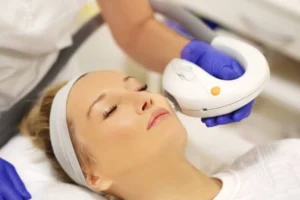 أفضل أنواع الليزر لعلاج الكلف في تركيا