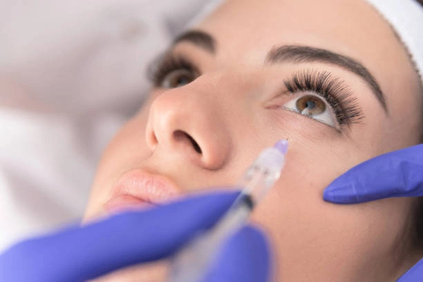 الهالات السوداء: فيلر تحت العين أم ميزو/سكين بوستر؟ الهالات السوداء تحت العين