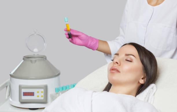 علاج البلازما PRP