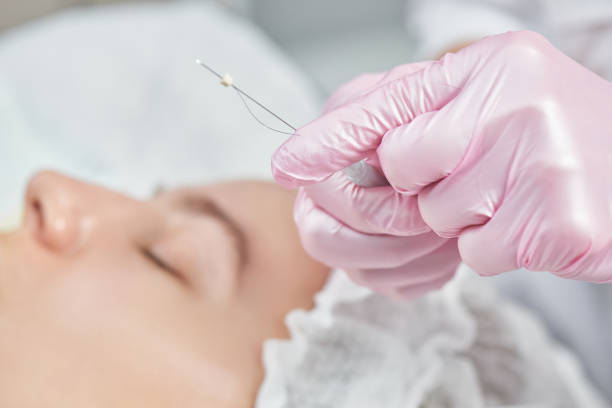 مكونات الحقن ودورها في منح النضارة