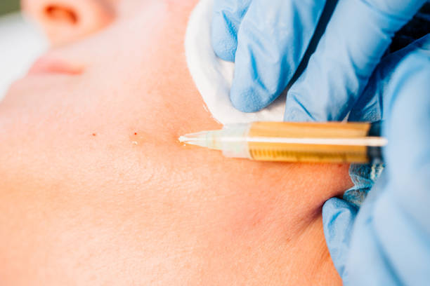 ما هو علاج البلازما وكيف يعمل؟