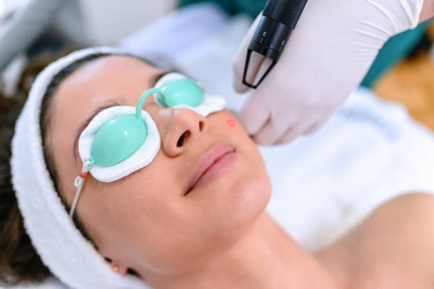 العناية بعد الجلسة