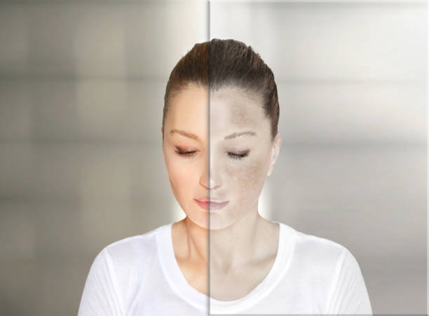 أنواع التصبغات التي تستجيب لجلسة واحدة