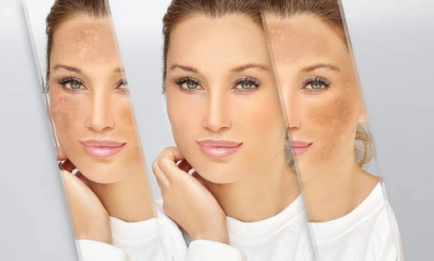 بروتوكول ترميم البشرة بعد الصيف