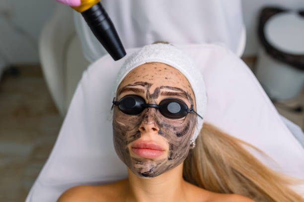 كيف تُزال التصبغات بالليزر أو التقشير؟