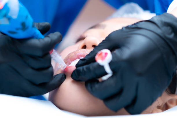 كم تدوم نتائج توريد الشفاه بالسيستم؟