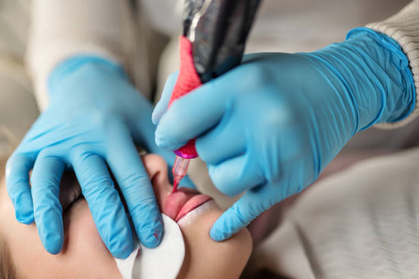 الفرق بين التوريد العادي وتقنية الـSystem