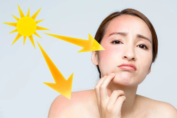 علاج آثار الشمس بمواد مخصّصة للتصبغات