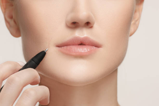 علاج الخطوط الدقيقة حول الفم بمواد خفيفة