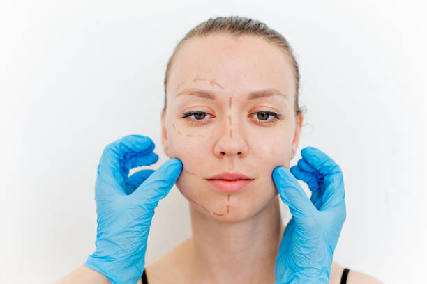 إعادة بناء حاجز البشرة