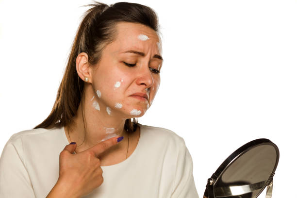 لماذا لا تنفع الكريمات العشوائية؟