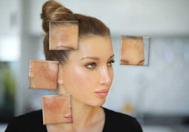 أنواع التصبغات وكيف نفرّق بينها