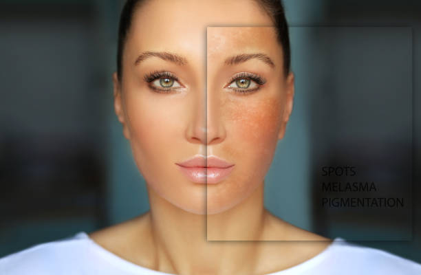 بروتوكول صباح/مساء 6 أسابيع