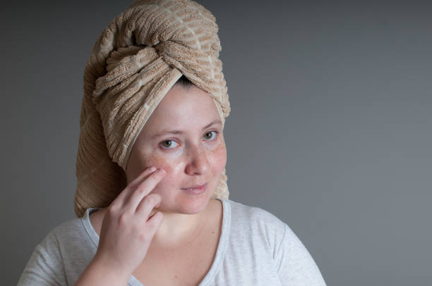 روتين العناية بالبشرة الدهنية