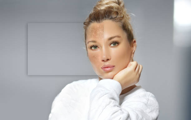 علاج الجفاف من الجذور