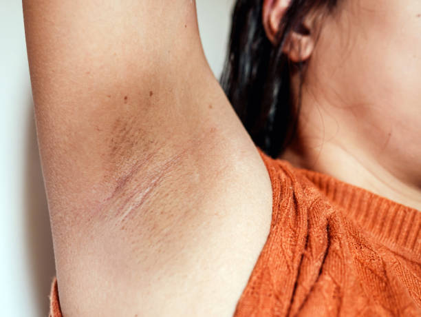 أسباب الاسمرار