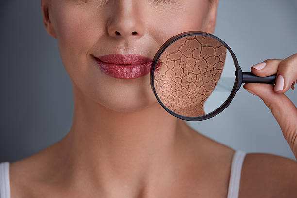 لماذا يزداد الجفاف بالشتاء؟