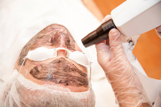 جلسات داعمة: تقشير – ميزو – ليزر