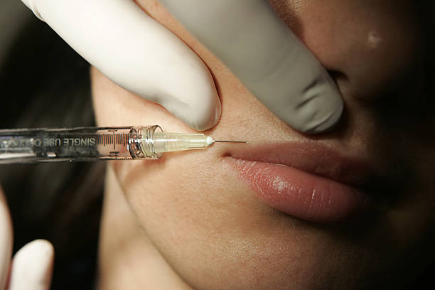 الفيلر والبوتوكس الطبيعي