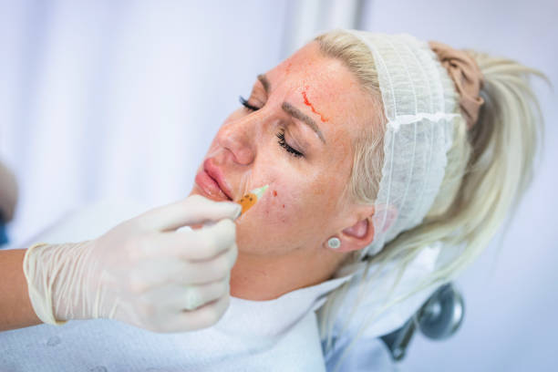 أخطاء التجميل غير الجراحي اختيار غير مناسب للعلاج