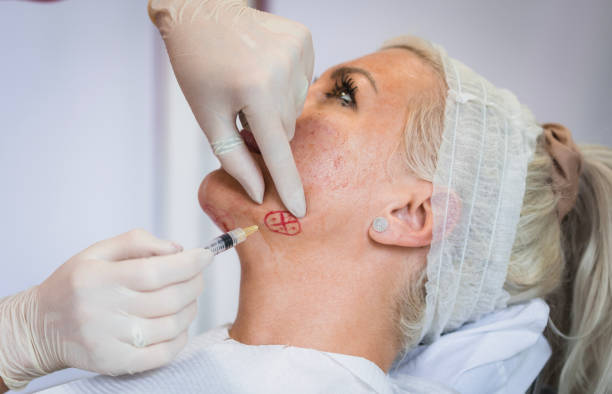 حقن البوتوكس التجميلي