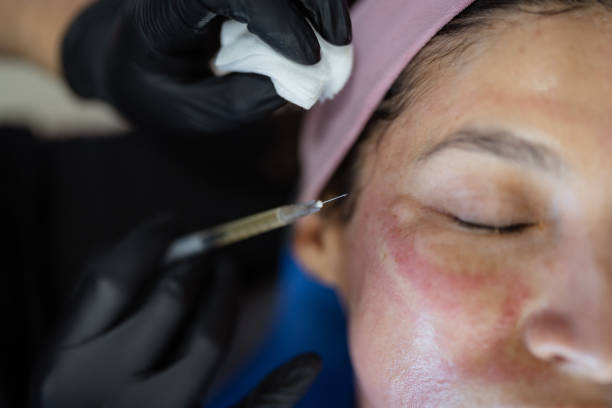 سكين بوستر للبشرة