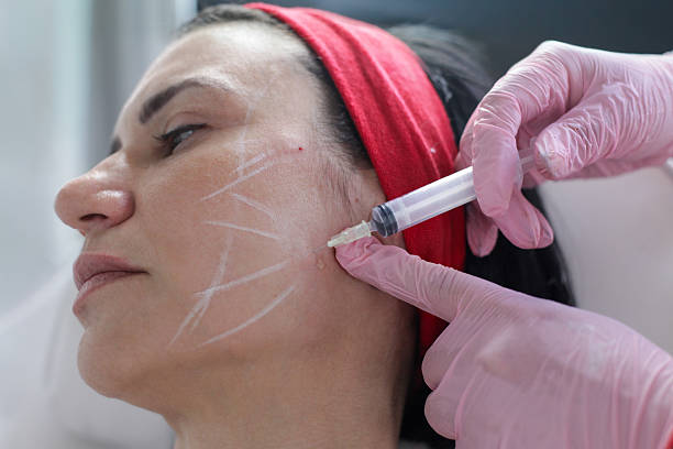 شد الوجه بدون جراحة عدد الجلسات المطلوبة