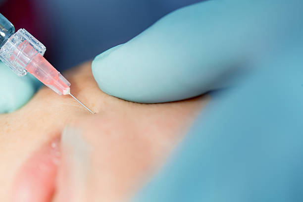 الفيلر والبوتوكس