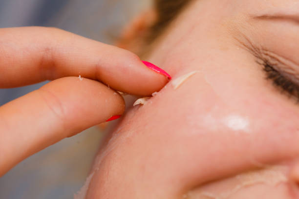 أخطاء التجميل غير الجراحي الإفراط في الحقن